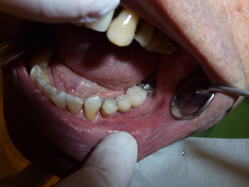 5 советов, которые помогут выбрать идеального стоматолога - фото 3