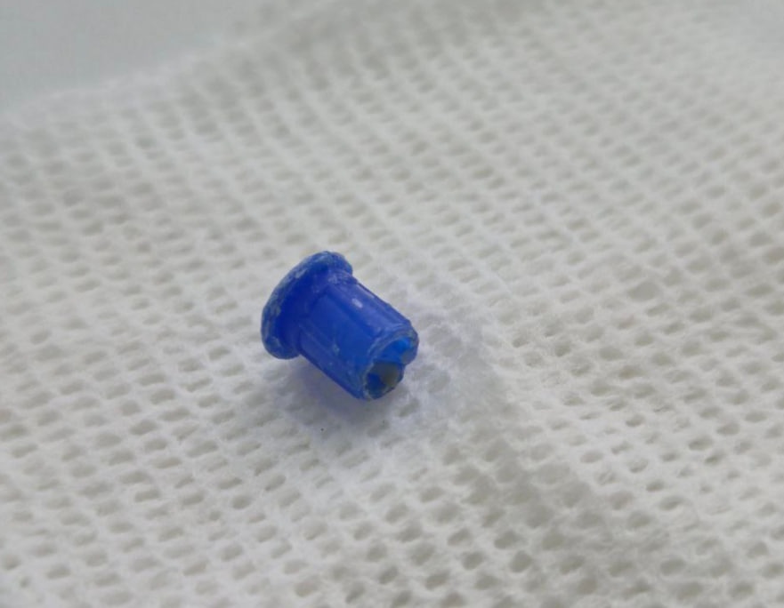 Колпачок от ручки нашли в легких ребенка в Нижнем Новгороде - фото 1